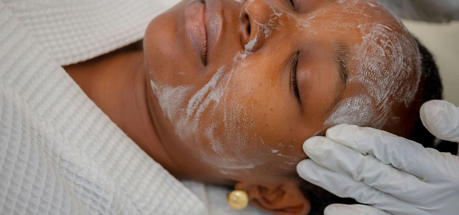 Tratamiento contra las manchas